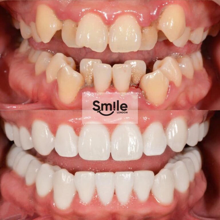 orthodontics before & after