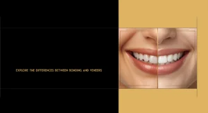 Veneers vs composite bonding blog featured image