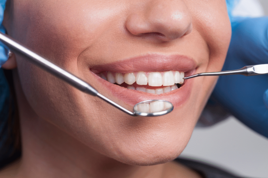 Natural-looking minimal-prep veneers at Smile London | a safer alternative to turkey teeth 